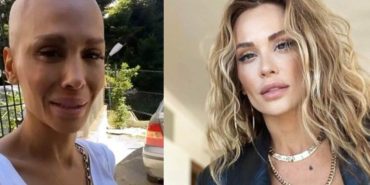 hastaligi-yeniden-nuksetmisti-sarki-uxkr