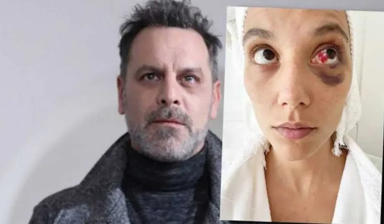 Ozan Güven’in Deniz Bulutsuz’a Şiddet Davasında Karar Kesinleşti