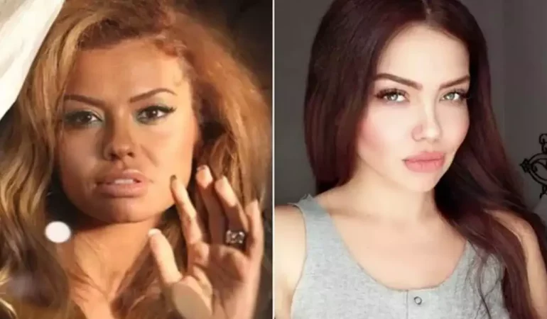 Beyninde Kitle Tespit Edilen Şarkıcı Lara’dan Üzen Paylaşım!