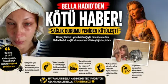 Endişe Büyüyor! Bella Hadid’in Sağlık Durumu Kritikleşti