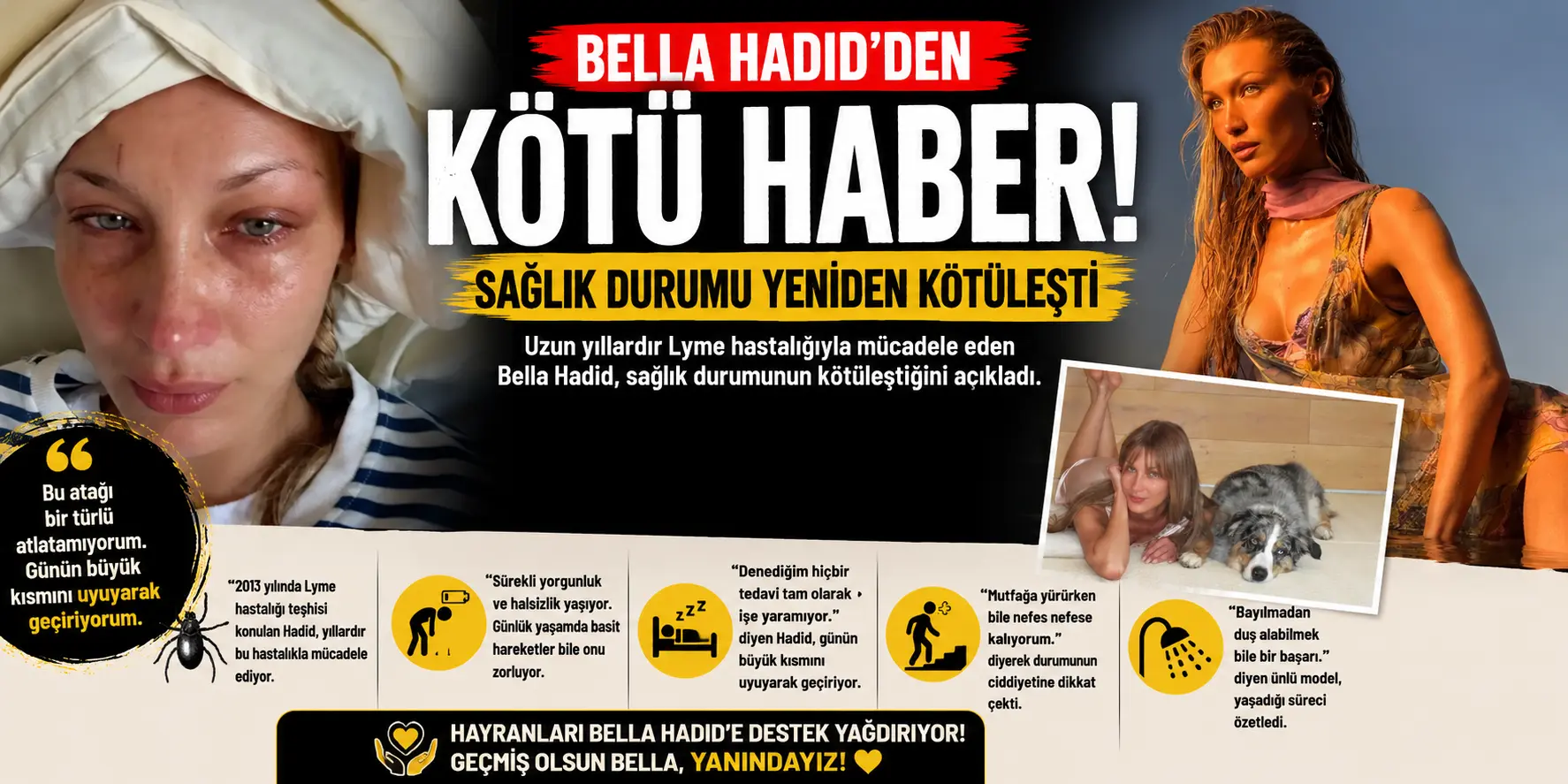 Endişe Büyüyor! Bella Hadid’in Sağlık Durumu Kritikleşti