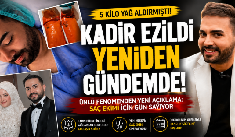 Vücudundaki değişimle konuşulmuştu: Kadir Ezildi yeni operasyonda