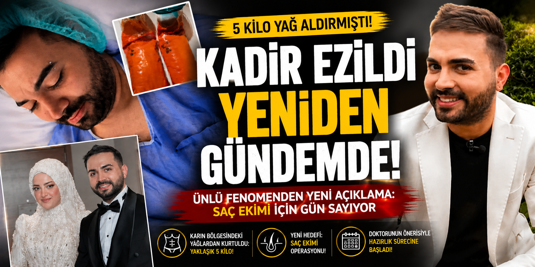 Vücudundaki değişimle konuşulmuştu: Kadir Ezildi yeni operasyonda