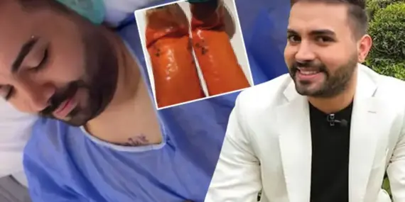 Kadir Ezildi Hastaneye Yattı: Ameliyat Sonrası 5 Kilo Yağ Alındı