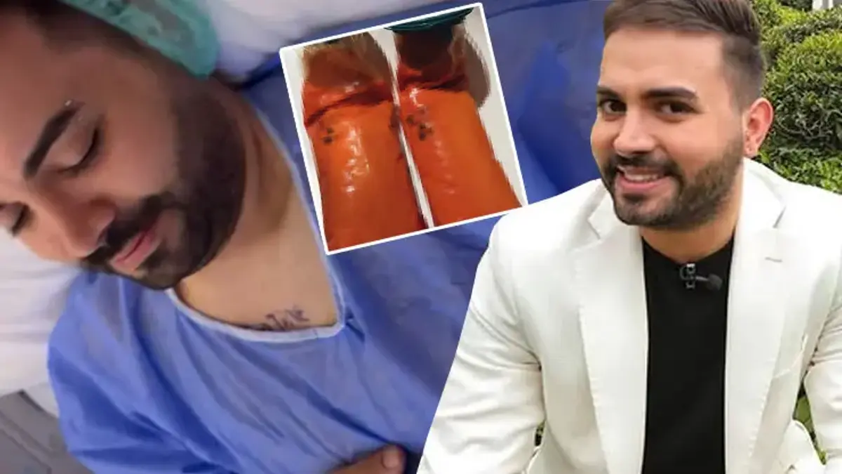 Kadir Ezildi Hastaneye Yattı: Ameliyat Sonrası 5 Kilo Yağ Alındı