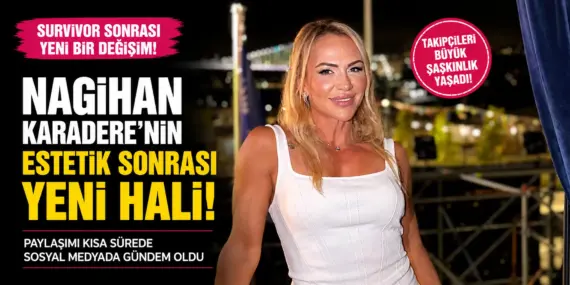Survivor Nagihan Estetikle Değişti! Son Hali Gündemi Salladı