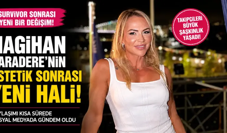 Survivor Nagihan Estetikle Değişti! Son Hali Gündemi Salladı