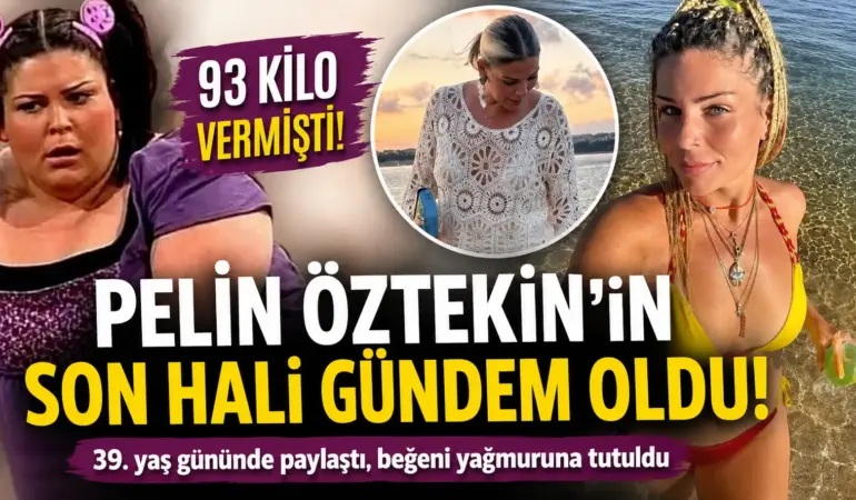 93 Kilo Vermişti! Pelin Öztekin’in Son Hali Sosyal Medyayı Salladı