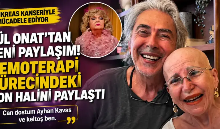 Pankreas Kanseriyle Mücadele Eden Gül Onat’tan Yürek Burkan Paylaşım!