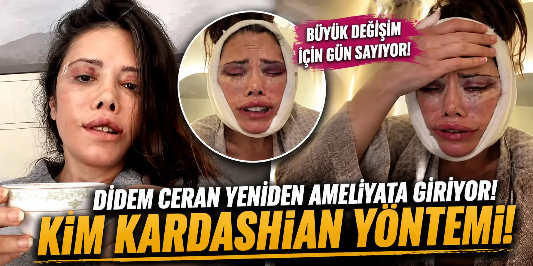 Didem Ceran Yine Ameliyat Masasında! Yeni Hedefi Kim Kardashian Görünümü