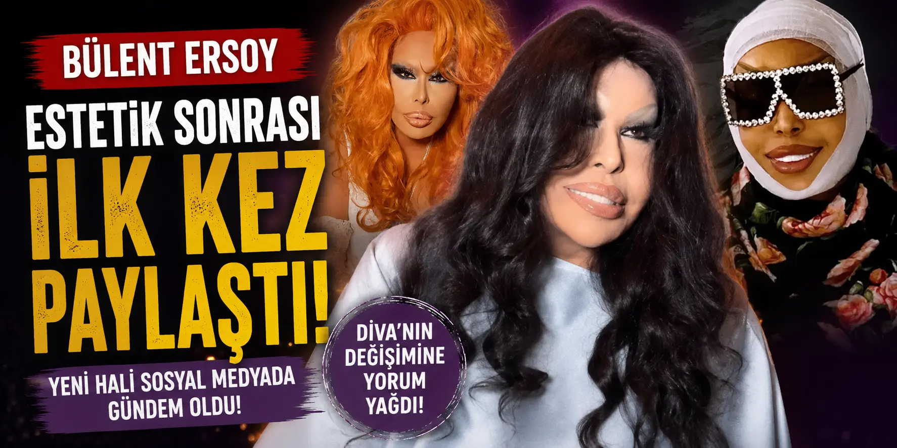 Bülent Ersoy’un Estetik Sonrası Hali Olay Oldu! Sosyal Medyada Yorum Yağdı