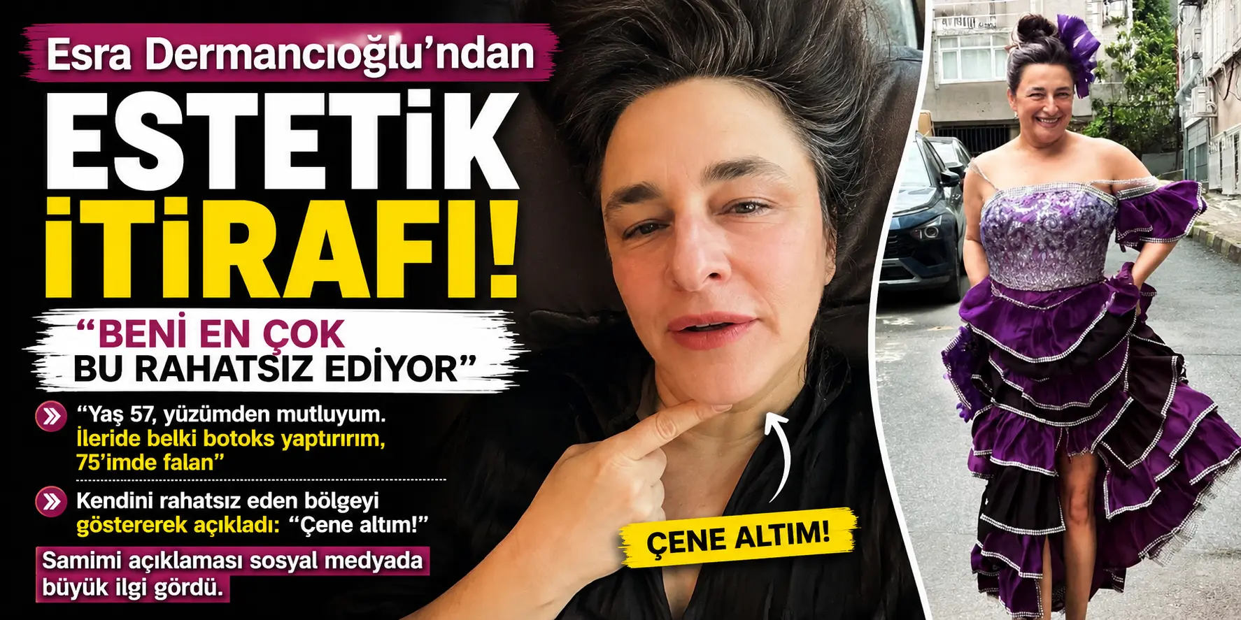 57 yaşındaki Esra Dermancıoğlu açıkladı! Estetik yaptıracağı yeri gösterdi