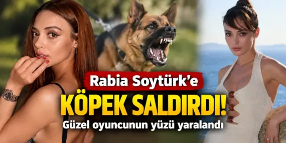 Güzel Oyuncuya Köpek Dehşeti! Rabia Soytürk Hastanelik Oldu