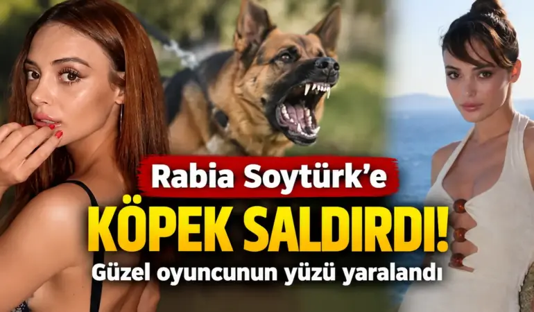 Güzel Oyuncuya Köpek Dehşeti! Rabia Soytürk Hastanelik Oldu