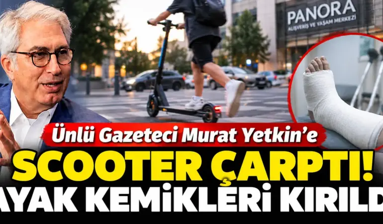 Murat Yetkin’e Scooter Çarptı! Yola Savruldu, Ayak Kemikleri Kırıldı