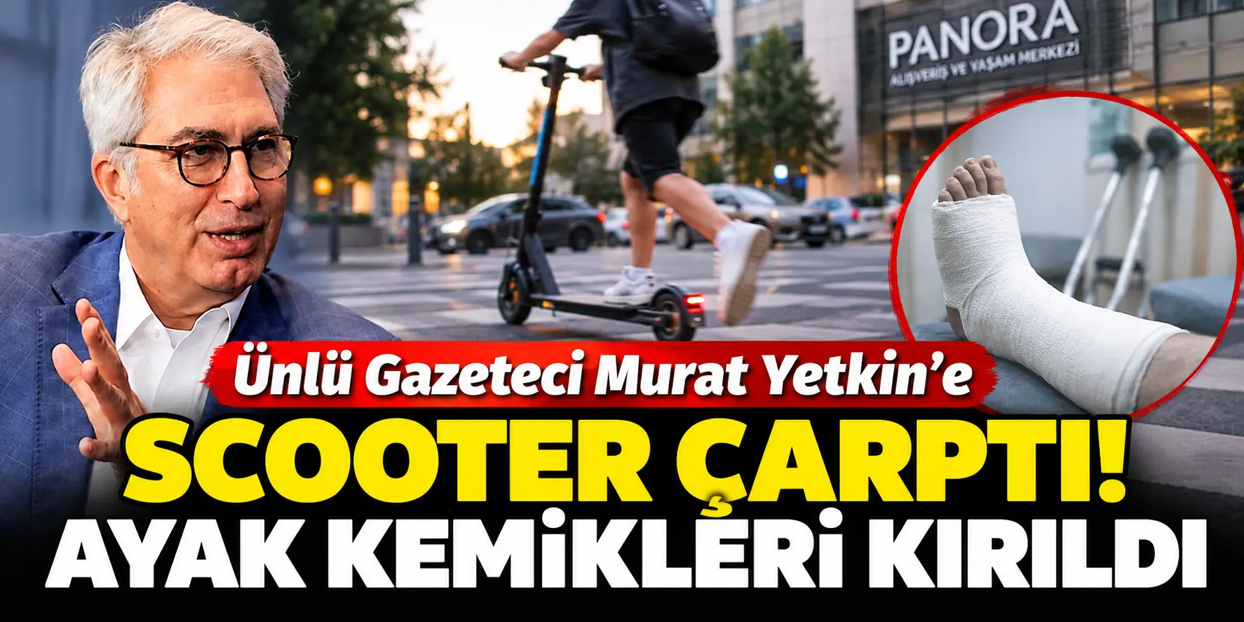 Murat Yetkin’e Scooter Çarptı! Yola Savruldu, Ayak Kemikleri Kırıldı