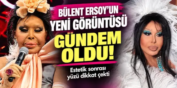Bülent Ersoy’un Son Hali Olay Yarattı! “Lolita” Estetiği Sonrası Görüntüsü Gündem Oldu
