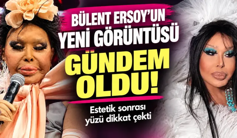 Bülent Ersoy’un Son Hali Olay Yarattı! “Lolita” Estetiği Sonrası Görüntüsü Gündem Oldu