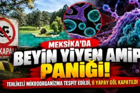 Meksika’da Beyin Yiyen Amip Paniği