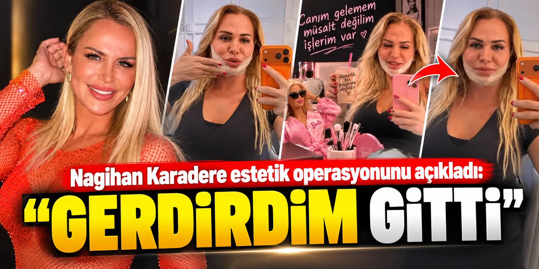 Nagihan Karadere’nin Estetik Dönüşümü